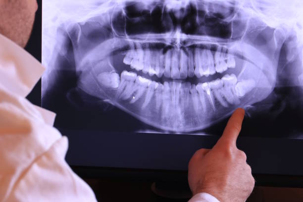 Best Emergency Root Canal Treatment in Brewster, OH